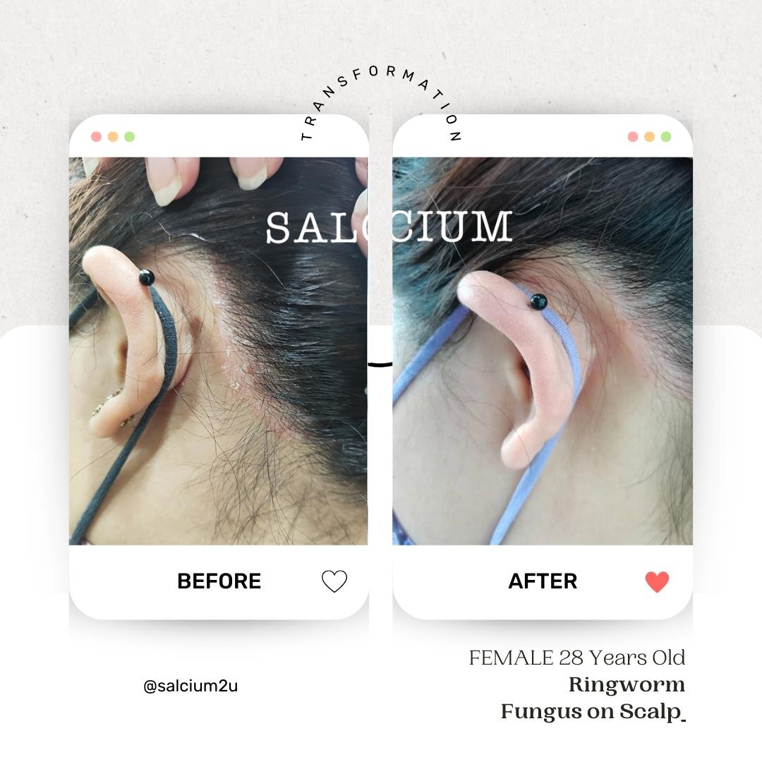 SalCium® Organic Scalp Care System