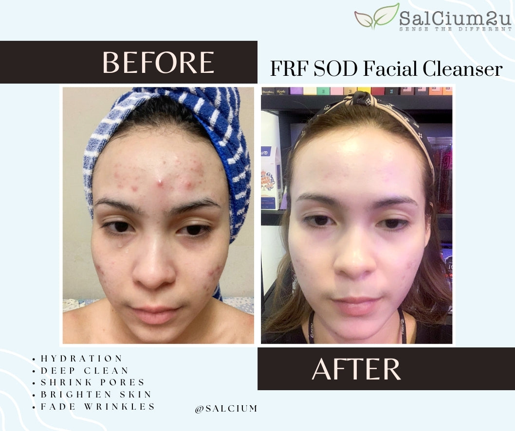 SalCium® FRF SOD Facial Cleanser 100㎖ℯ